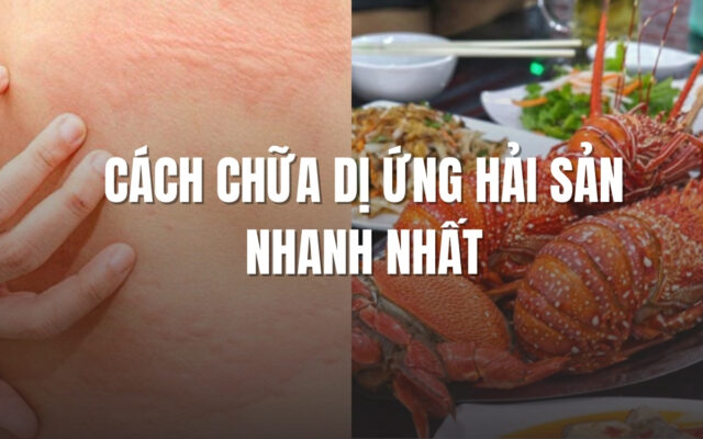 Cách chưa trị dị ứng hải sản nhanh nhất