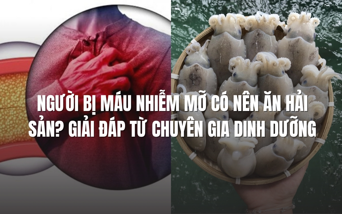 Người bị máu nhiễm mỡ có nên ăn hải sản không?