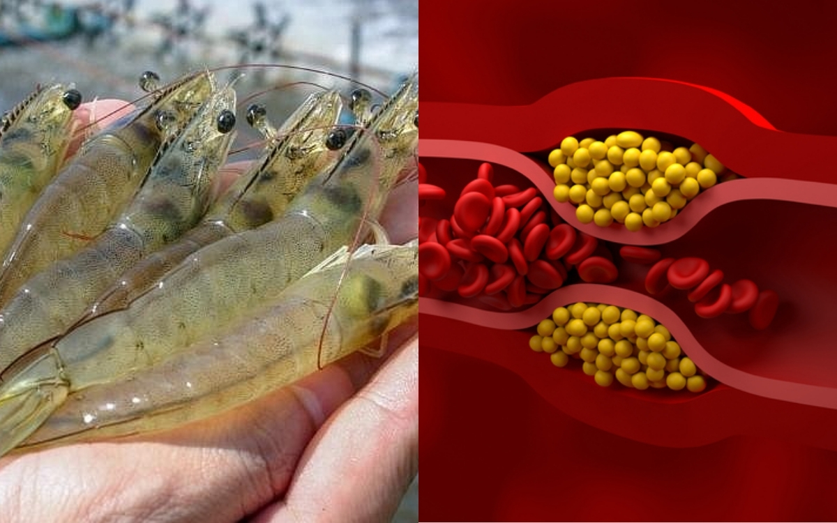 Cholesterol Tự Nhiên – Không Gây Hại Nếu Ăn Điều Độ và Kết Hợp Cùng Thực Phẩm Lành Mạnh
